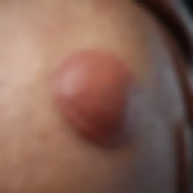Understanding Closed Comedones Close-up view of closed comedones on skin